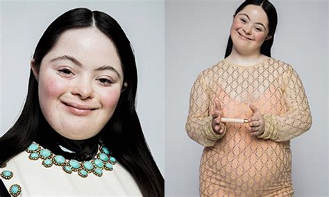 gucci mannequin trisomique|“We can model like anyone else, with or without a disability”: .